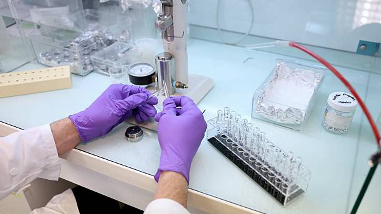 Scientists Reveal Mechanism of Nuclear Gateways Regulating Cell Traffic