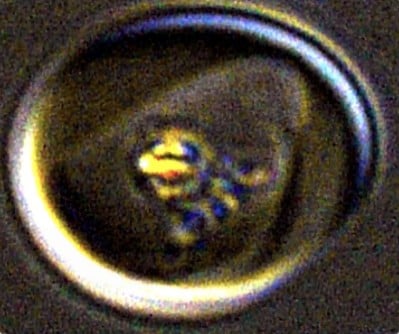 Scientists Uncover Mechanism Behind Malaria Parasite”s Iron Crystals